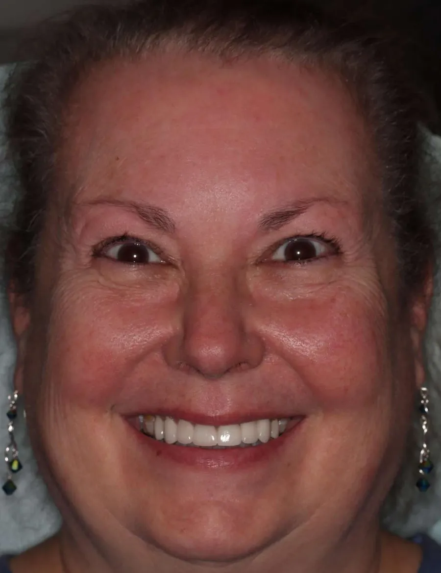 After: the new smile