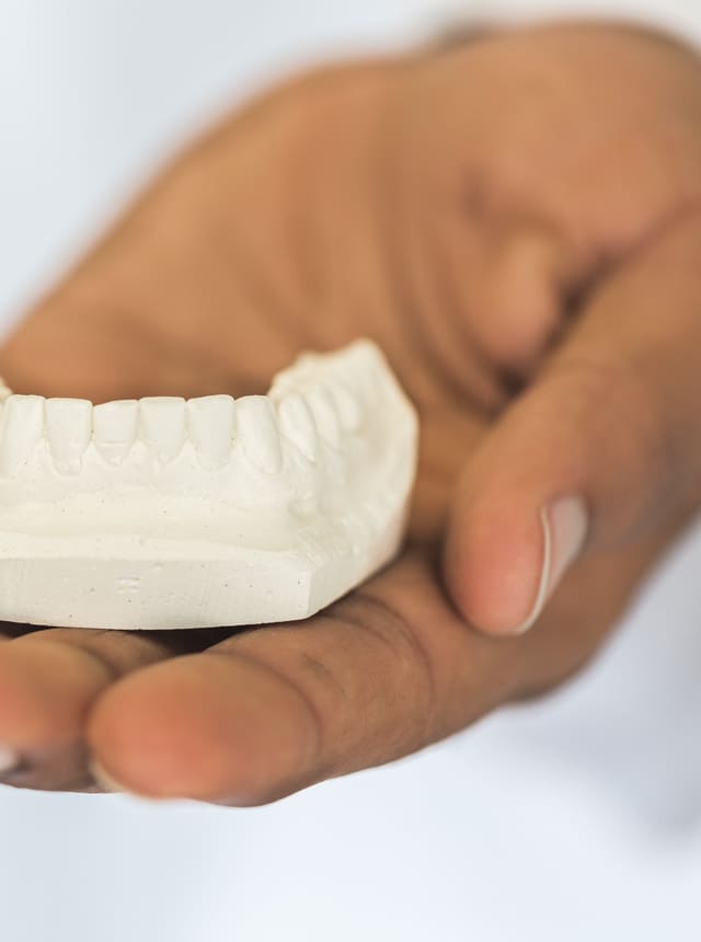 Hands holding a white dental model