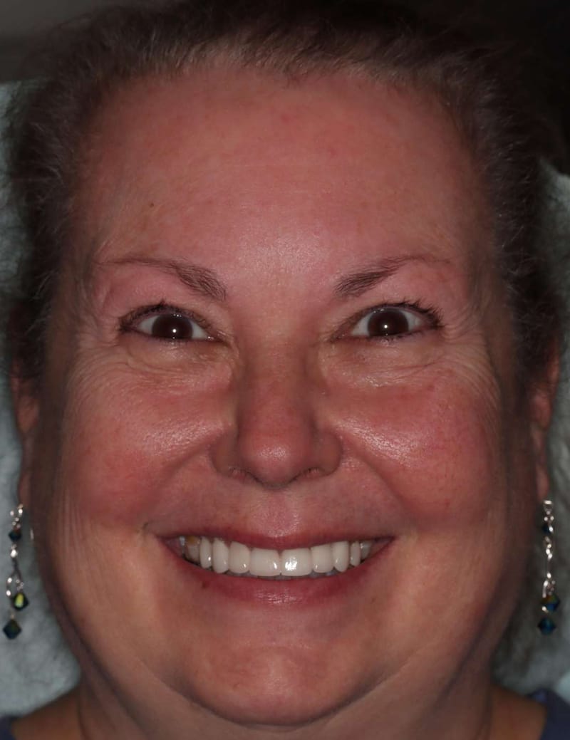 After: the same woman with her new smile