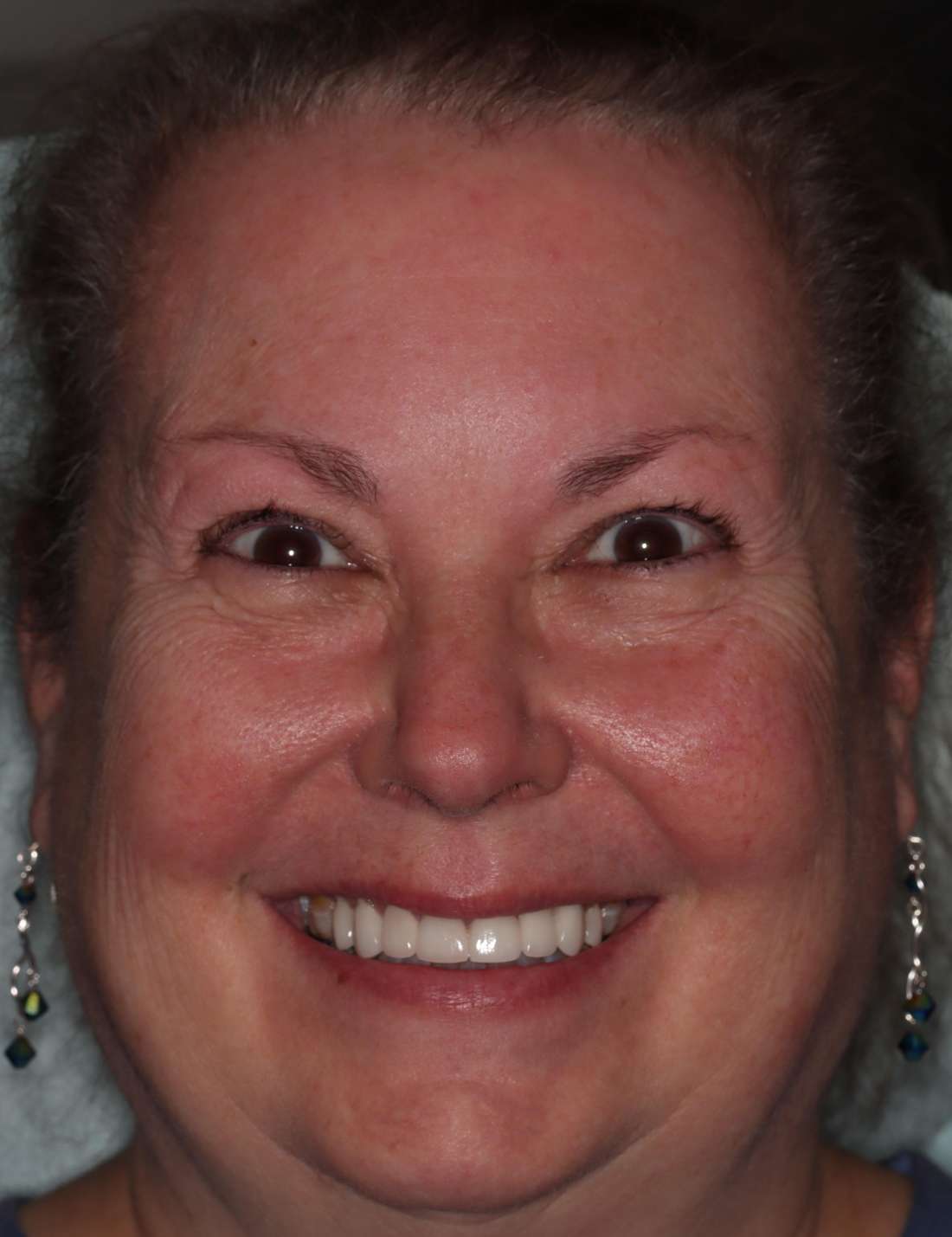 After: a new smile planned digitally